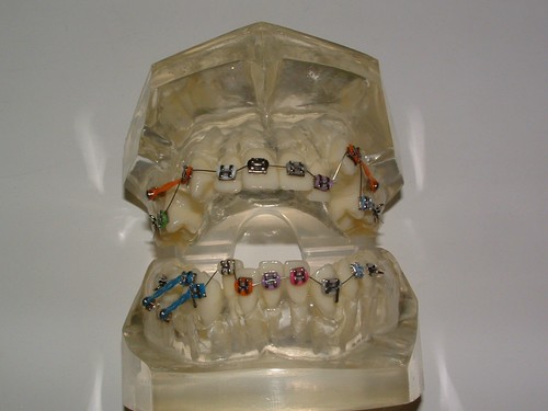 Dental zahnarzt zahntechnik - dental,