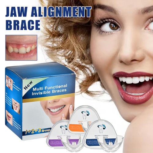 Zahnspange dental brace - zahnspange,